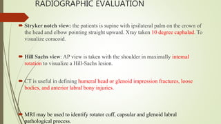 RADIOGRAPHIC EVALUATION
 Stryker notch view: the patients is supine with ipsilateral palm on the crown of
the head and elbow pointing straight upward. Xray taken 10 degree caphalad. To
visualize coracoid.
 Hill Sachs view: AP view is taken with the shoulder in maximally internal
rotation to visualize a Hill-Sachs lesion.
 CT is useful in defining humeral head or glenoid impression fractures, loose
bodies, and anterior labral bony injuries.
 MRI may be used to identify rotator cuff, capsular and glenoid labral
pathological process.
 