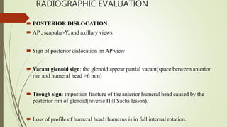RADIOGRAPHIC EVALUATION
 POSTERIOR DISLOCATION:
 AP , scapular-Y, and axillary views
 Sign of posterior dislocation on AP view
 Vacant glenoid sign: the glenoid appear partial vacant(space between anterior
rim and humeral head >6 mm)
 Trough sign: impaction fracture of the anterior humeral head caused by the
posterior rim of glenoid(reverse Hill Sachs lesion).
 Loss of profile of humeral head: humerus is in full internal rotation.
 