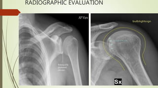 RADIOGRAPHIC EVALUATION
 