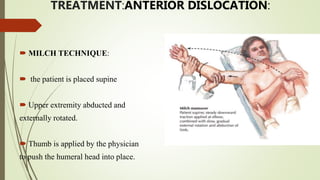 TREATMENT:ANTERIOR DISLOCATION:
 MILCH TECHNIQUE:
 the patient is placed supine
 Upper extremity abducted and
externally rotated.
 Thumb is applied by the physician
to push the humeral head into place.
 