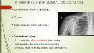 INFERIOR GLENOHUMERAL DISLOCATION
 Also known as LUXATIO ERECTA.
 Very rare,
 more common in elderly individuals.
 Mechanism of injury:
It results from a hyperabduction force causing
impingement of the neck of the humerus on the
acromion, which levers the humeral head out inferiorly.
 