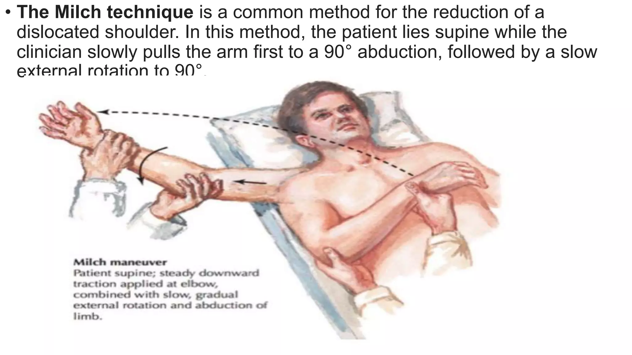 Shoulder Reduction Methodes Shoulder dislocation.pptx