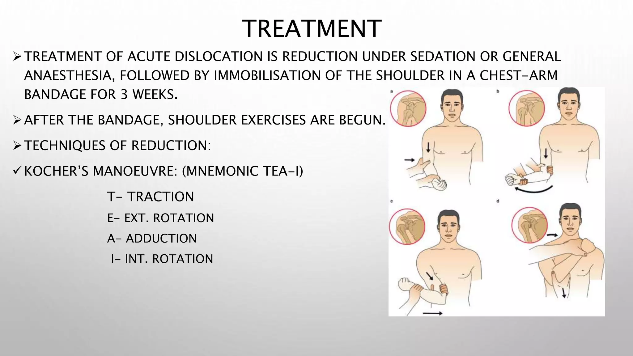 Shoulder dislocation.pptx