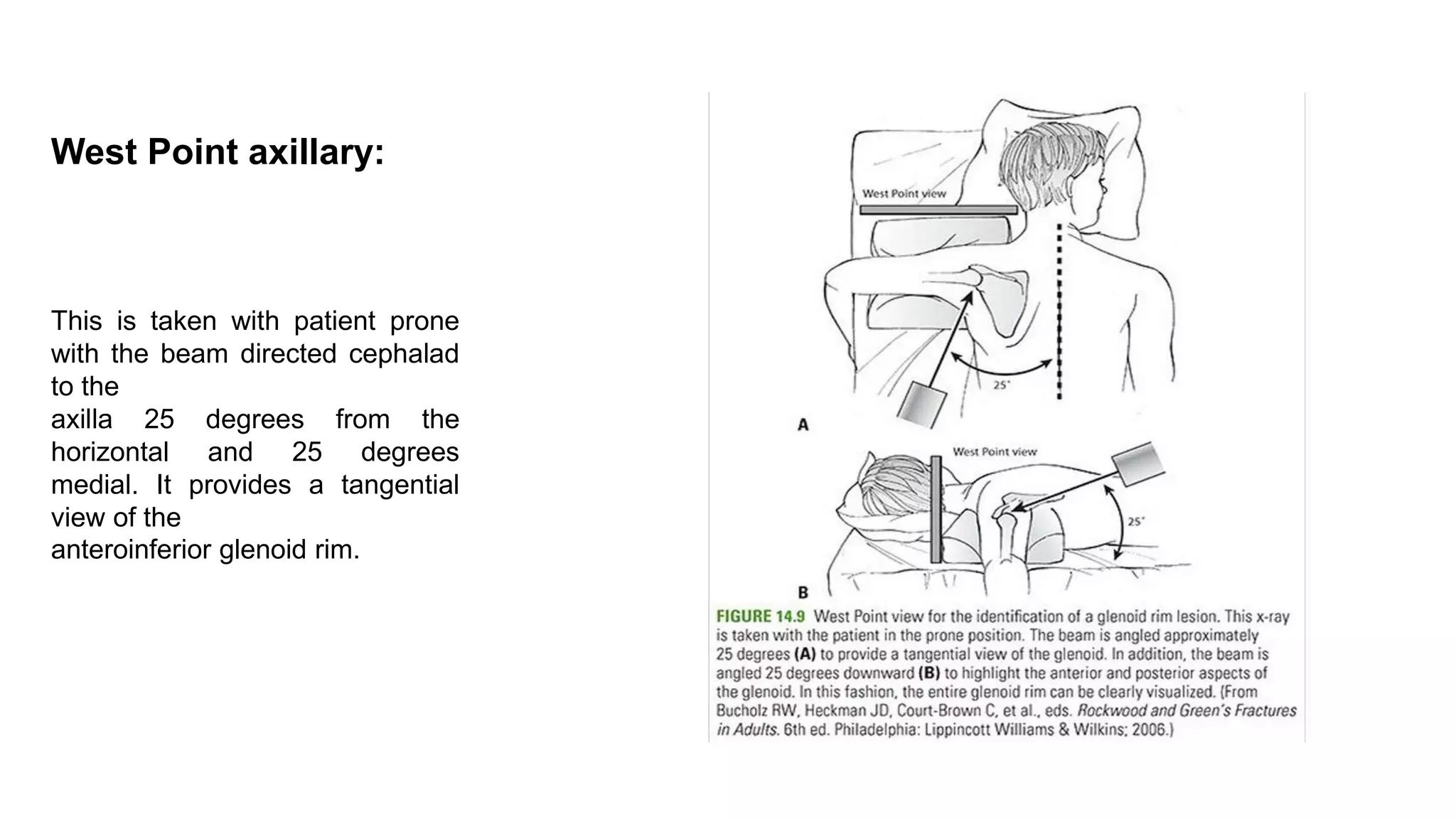 West Point axillary:
This is taken with patient prone
with the beam directed cephalad
to the
axilla 25 degrees from the
horizontal and 25 degrees
medial. It provides a tangential
view of the
anteroinferior glenoid rim.
 