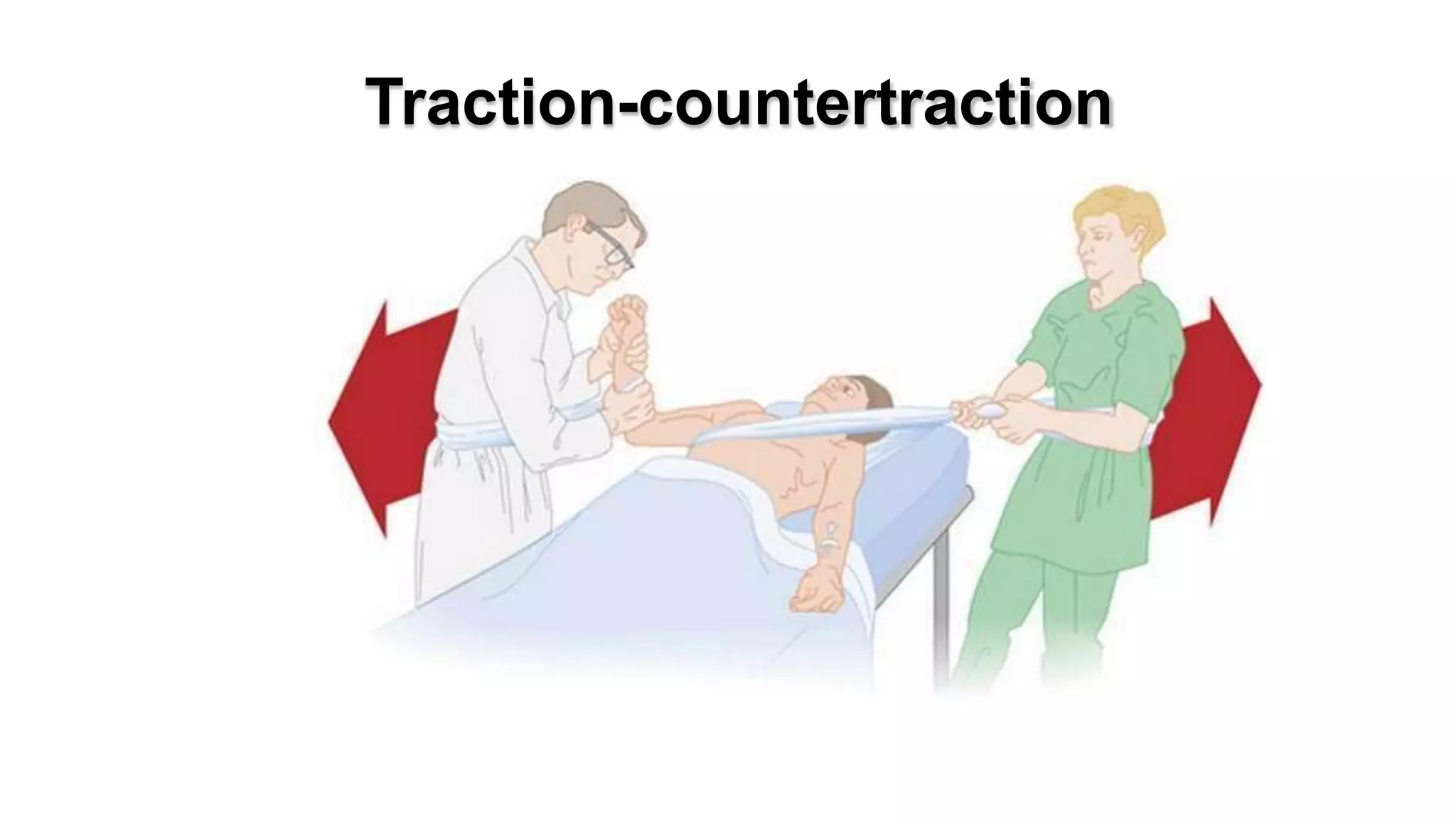 Traction-countertraction
 