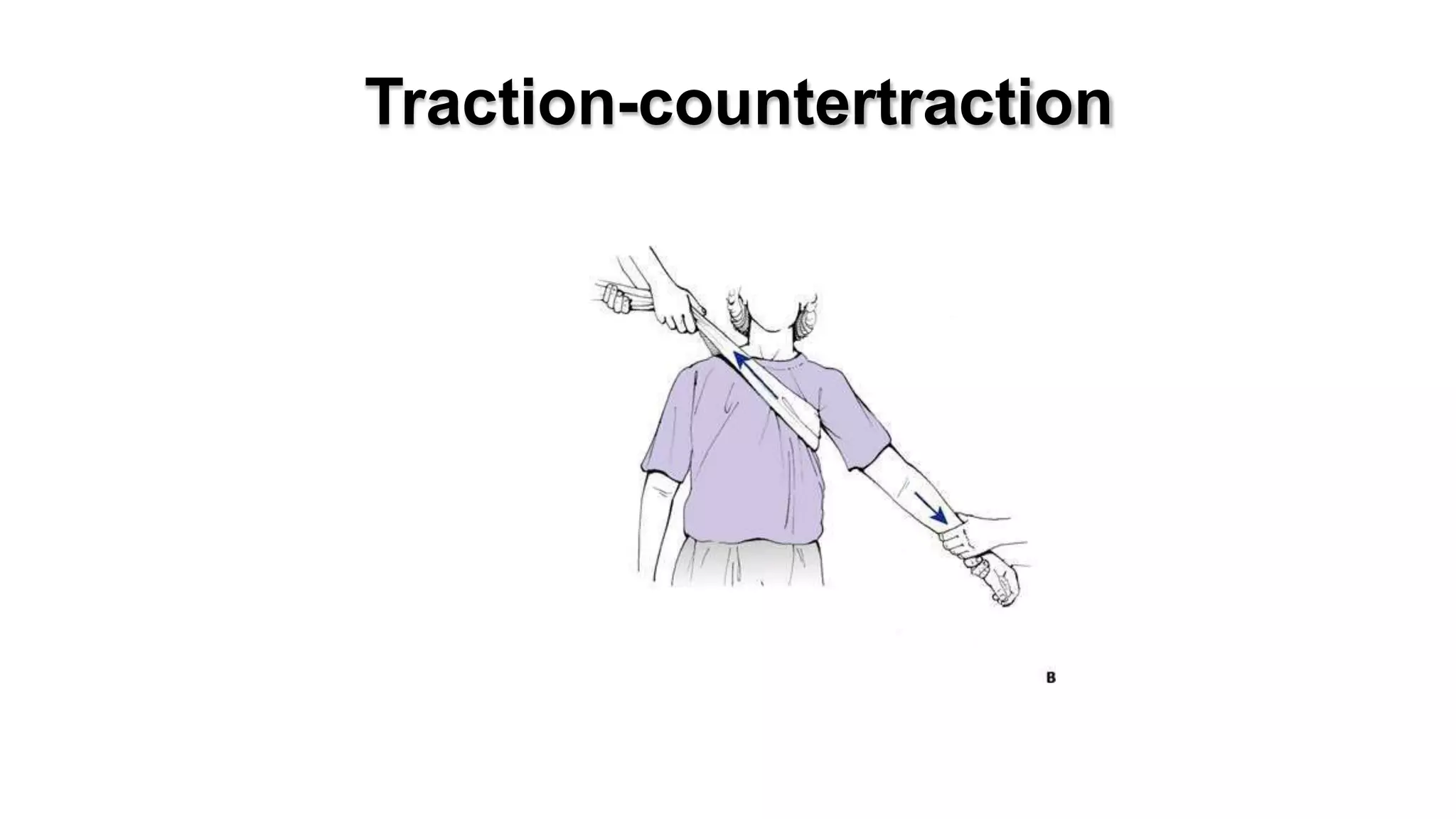 Traction-countertraction
 