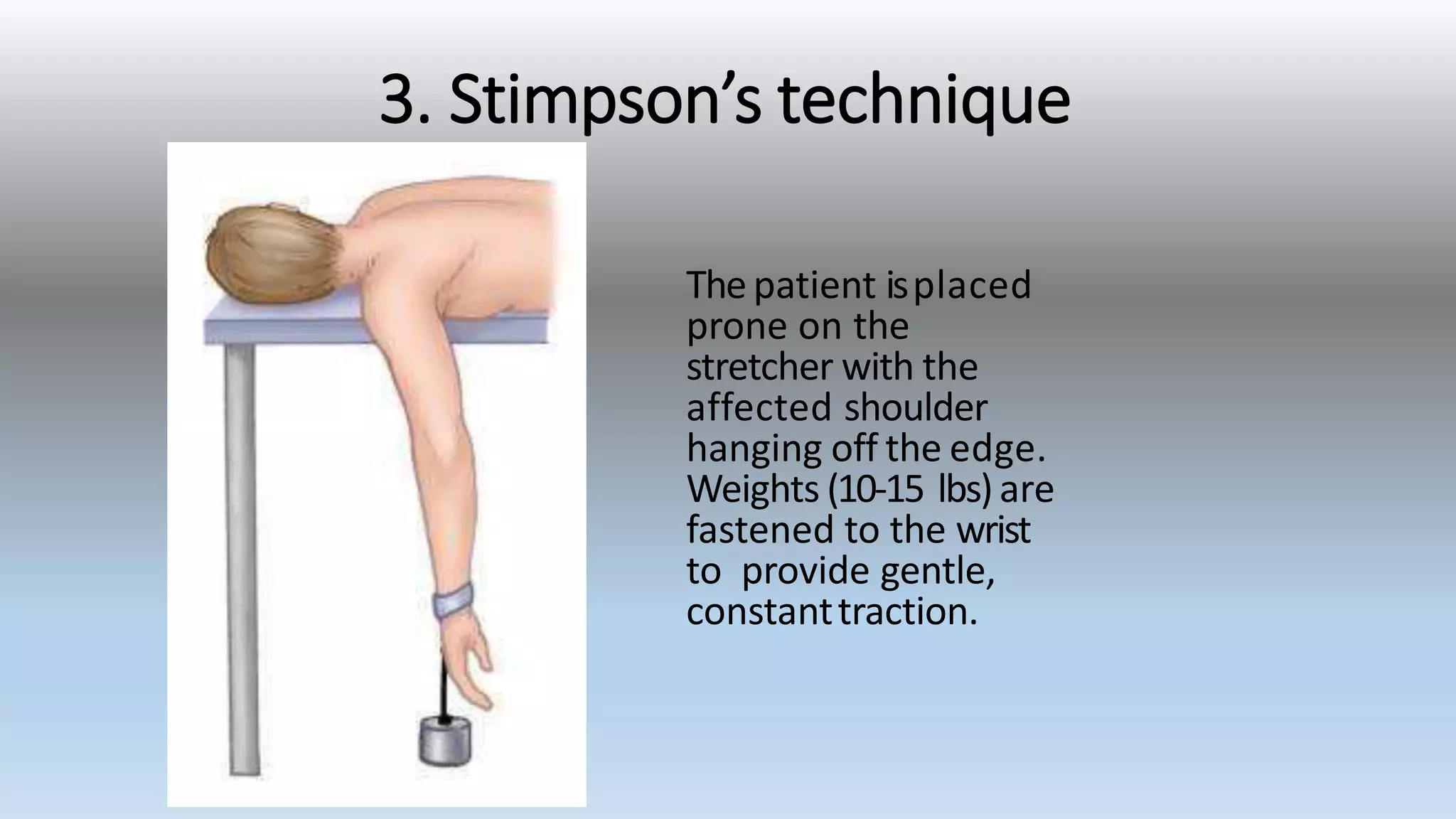 3. Stimpson’s technique
The patient isplaced
prone on the
stretcher with the
affected shoulder
hanging off the edge.
Weights (10-15 lbs)are
fastened to the wrist
to provide gentle,
constanttraction.
 