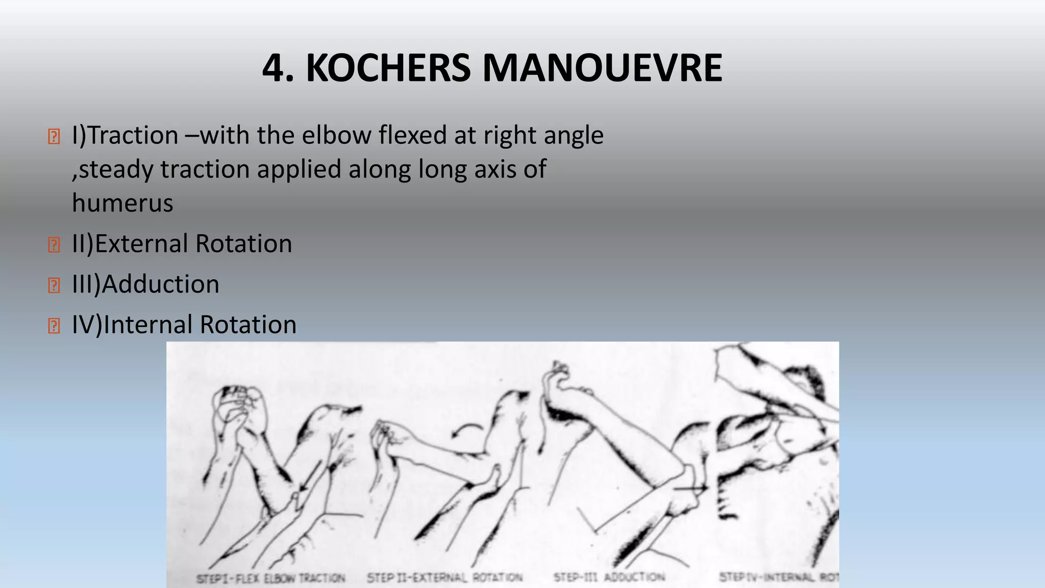 4. KOCHERS MANOUEVRE
I)Traction –with the elbow flexed at right angle
,steady traction applied along long axis of
humerus
II)External Rotation
III)Adduction
IV)Internal Rotation
 