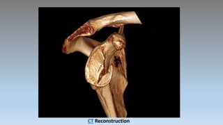 CT Reconstruction
 
