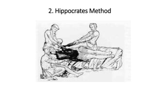 2. Hippocrates Method
 