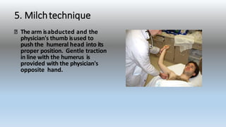 5. Milchtechnique
The arm isabducted and the
physician's thumb isused to
push the humeral head into its
proper position. Gentle traction
in line with the humerus is
provided with the physician's
opposite hand.
 