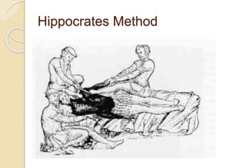 Hippocrates Method
 
