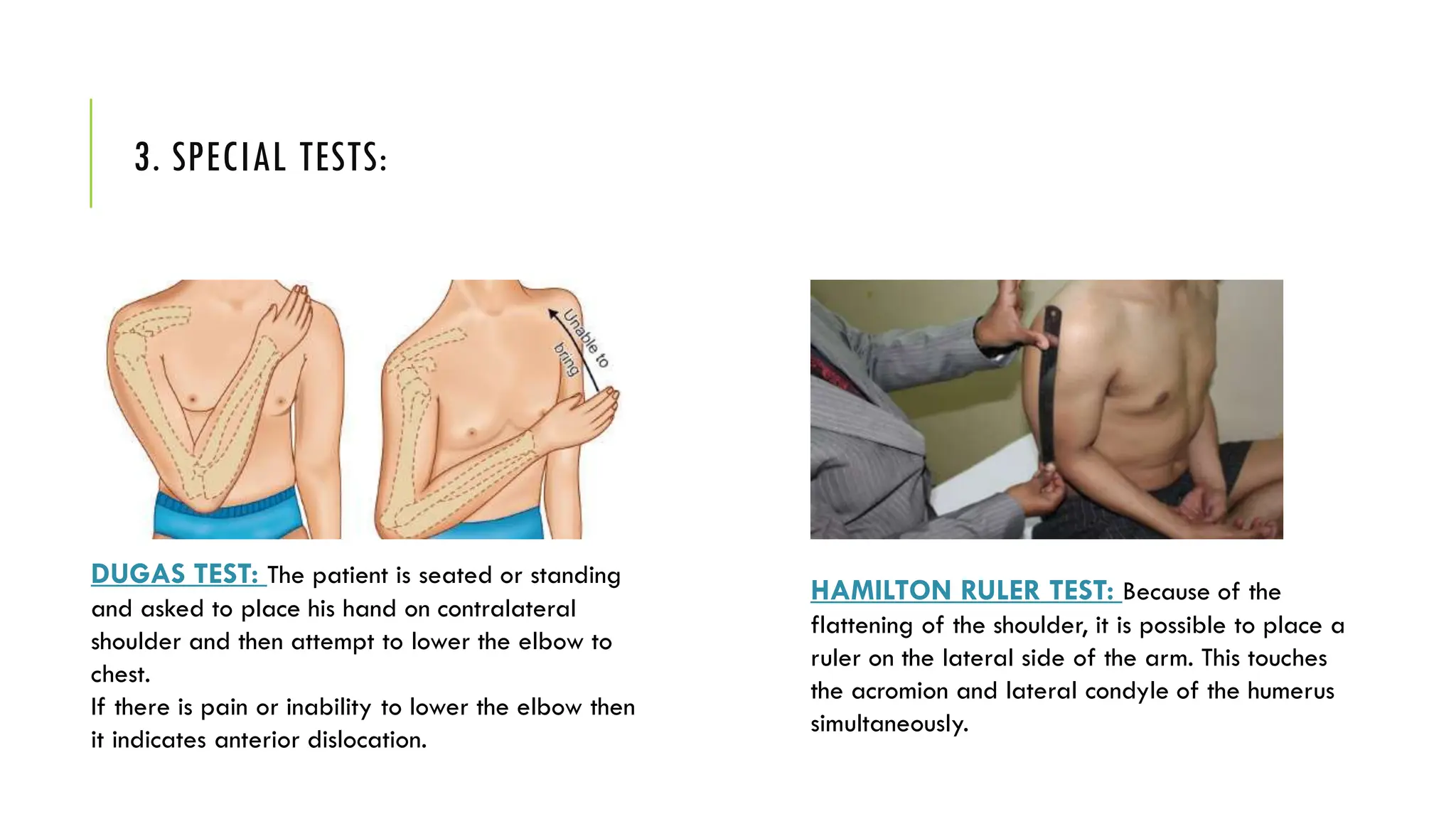 3. SPECIAL TESTS:
DUGAS TEST: The patient is seated or standing
and asked to place his hand on contralateral
shoulder and then attempt to lower the elbow to
chest.
If there is pain or inability to lower the elbow then
it indicates anterior dislocation.
HAMILTON RULER TEST: Because of the
flattening of the shoulder, it is possible to place a
ruler on the lateral side of the arm. This touches
the acromion and lateral condyle of the humerus
simultaneously.
 