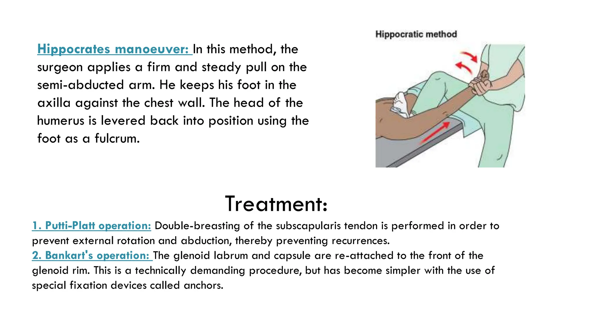 Hippocrates manoeuver: In this method, the
surgeon applies a firm and steady pull on the
semi-abducted arm. He keeps his foot in the
axilla against the chest wall. The head of the
humerus is levered back into position using the
foot as a fulcrum.
Treatment:
1. Putti-Platt operation: Double-breasting of the subscapularis tendon is performed in order to
prevent external rotation and abduction, thereby preventing recurrences.
2. Bankart's operation: The glenoid labrum and capsule are re-attached to the front of the
glenoid rim. This is a technically demanding procedure, but has become simpler with the use of
special fixation devices called anchors.
 