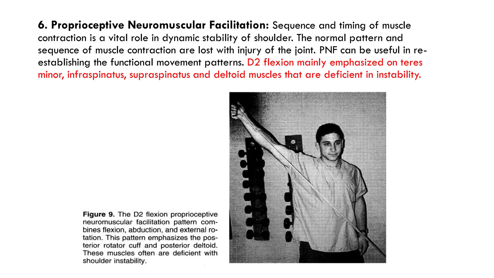 6. Proprioceptive Neuromuscular Facilitation: Sequence and timing of muscle
contraction is a vital role in dynamic stability of shoulder. The normal pattern and
sequence of muscle contraction are lost with injury of the joint. PNF can be useful in re-
establishing the functional movement patterns. D2 flexion mainly emphasized on teres
minor, infraspinatus, supraspinatus and deltoid muscles that are deficient in instability.
 