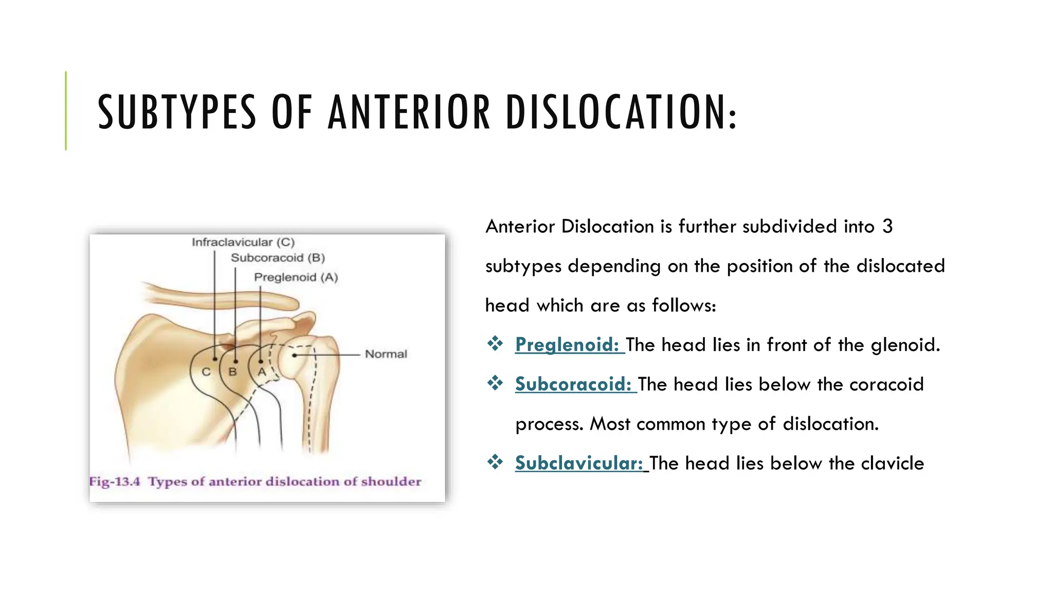 Anterior Dislocation is further subdivided into 3
subtypes depending on the position of the dislocated
head which are as follows:
 Preglenoid: The head lies in front of the glenoid.
 Subcoracoid: The head lies below the coracoid
process. Most common type of dislocation.
 Subclavicular: The head lies below the clavicle
SUBTYPES OF ANTERIOR DISLOCATION:
 