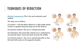 Shoulder Dislocation slideShare. PDF.pdf