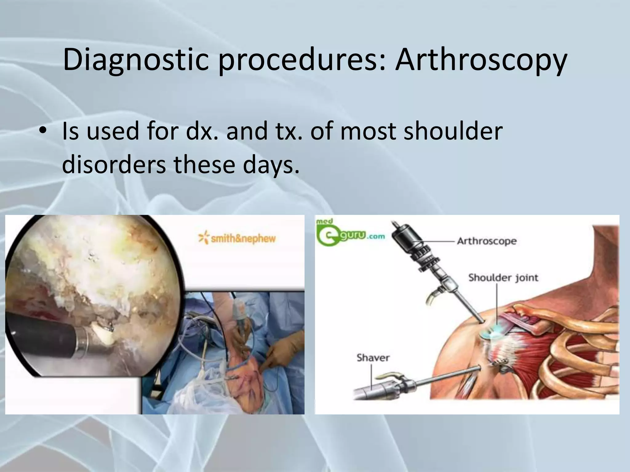 Diagnostic procedures: Arthroscopy
• Is used for dx. and tx. of most shoulder
disorders these days.
 