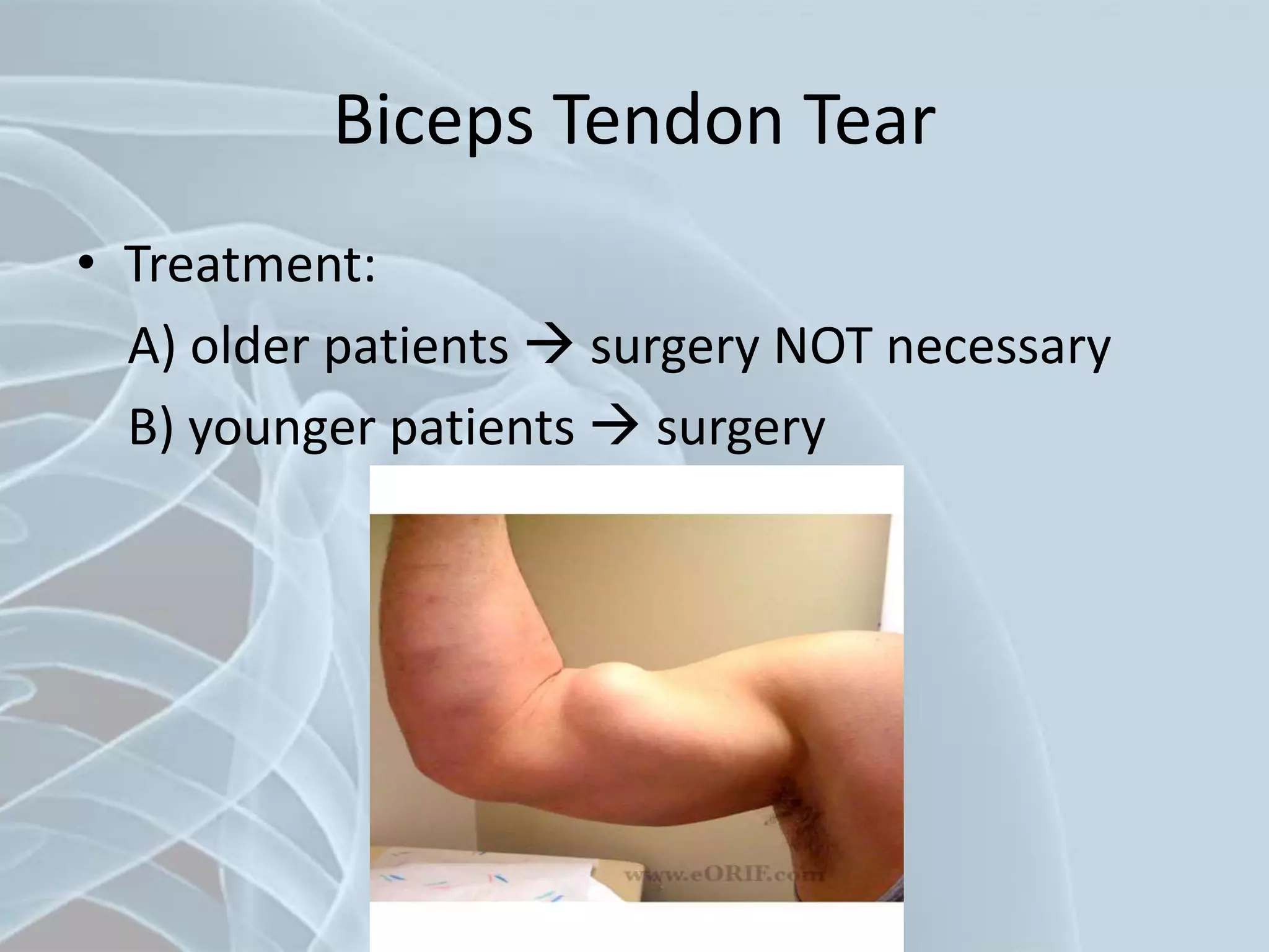 Biceps Tendon Tear
• Treatment:
A) older patients  surgery NOT necessary
B) younger patients  surgery
 