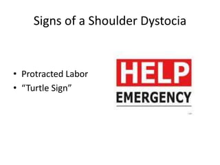 Signs of a Shoulder DystociaProtracted Labor                              “Turtle Sign”