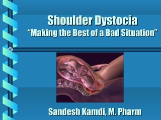 Shoulder Dystocia
“Making the Best of a Bad Situation”




     Sandesh Kamdi, M. Pharm
 
