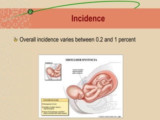 Incidence
Overall incidence varies between 0.2 and 1 percent
 