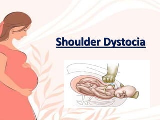 Shoulder Dystocia
 
