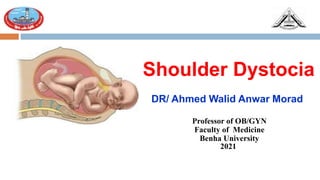 Shoulder Dystocia
DR/ Ahmed Walid Anwar Morad
Professor of OB/GYN
Faculty of Medicine
Benha University
2021
 