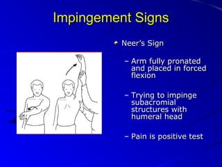 Impingement Signs
Neer’s Sign
– Arm fully pronated
and placed in forced
flexion
– Trying to impinge
subacromial
structures with
humeral head
– Pain is positive test

 