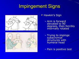 Impingement Signs
Hawkin’s Sign
– Arm is forward
elevated to 90
degrees, then forcibly
internally rotated
– Trying to impinge
subacromial
structures with
humeral head
– Pain is positive test

 