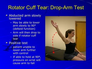 Rotator Cuff Tear: Drop-Arm Test
Abducted arm slowly
lowered
– May be able to lower
arm slowly to 90°
(deltoid function)
– Arm will then drop to
side if rotator cuff
tear

Positive test
– patient unable to
lower arm further
with control
– If able to hold at 90º,
pressure on wrist will
cause arm to fall

 