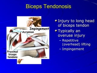 Biceps Tendonosis
Injury to long head
of biceps tendon
Typically an
overuse injury
– Repetitive
(overhead) lifting
– Impingement

 