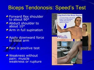 Biceps Tendonosis: Speed’s Test
Forward flex shoulder
to about 90°
Abduct shoulder to
about 10°
Arm in full supination
Apply downward force
to distal arm
Pain is positive test
Weakness without
pain: muscle
weakness or rupture

 