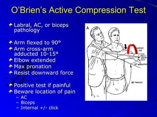 O’Brien’s Active Compression Test
Labral, AC, or biceps
pathology
Arm flexed to 90°
Arm cross-arm
adducted 10-15°
Elbow extended
Max pronation
Resist downward force
Positive test if painful
Beware location of pain
– AC
– Biceps
– Internal +/- click

 