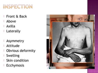    Front & Back
   Above
   Axilla
   Laterally

   Asymmetry
   Attitude
   Obvious deformity
   Swelling
   Skin condition
   Ecchymosis
 