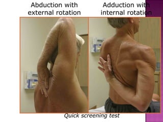 Abduction with          Adduction with
external rotation       internal rotation




           Quick screening test
 