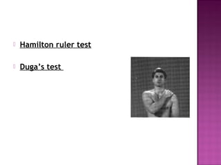    Hamilton ruler test

   Duga’s test
 