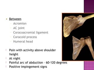 Between
     – Acromion
     – AC joint
     – Coracoacromial ligament
     – Coracoid process
     – Humeral head


   Pain with activity above shoulder
    height
   At night
   Painful arc of abduction – 60-120 degrees
   Positive impingement signs
 