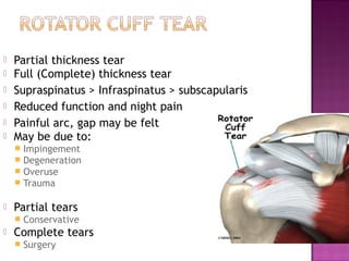    Partial thickness tear
   Full (Complete) thickness tear
   Supraspinatus > Infraspinatus > subscapularis
   Reduced function and night pain
   Painful arc, gap may be felt
   May be due to:
       Impingement
       Degeneration
       Overuse
       Trauma

   Partial tears
       Conservative
   Complete tears
       Surgery
 