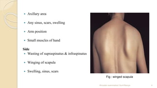  Axillary area
 Any sinus, scars, swelling
 Arm position
 Small muscles of hand
Side
 Wasting of supraspinatus & infraspinatus
 Winging of scapula
 Swelling, sinus, scars
Shoulder examination/ Sunil Baniya 4
Fig : winged scapula
 