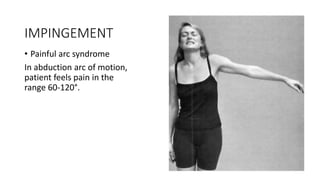 IMPINGEMENT
• Painful arc syndrome
In abduction arc of motion,
patient feels pain in the
range 60-120°.
 