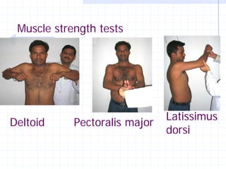 Muscle strength tests




                               Latissimus
Deltoid     Pectoralis major
                               dorsi
 