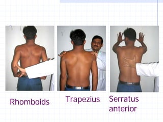Rhomboids   Trapezius   Serratus
                        anterior
 