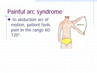 Painful arc syndrome
  In abduction arc of
 motion, patient feels
 pain in the range 60-
 120°.
 