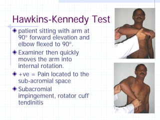 Hawkins-Kennedy Test
 patient sitting with arm at
 90° forward elevation and
 elbow flexed to 90°.
 Examiner then quickly
 moves the arm into
 internal rotation.
 +ve = Pain located to the
 sub-acromial space
 Subacromial
 impingement, rotator cuff
 tendinitis
 