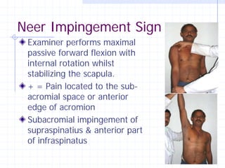 Neer Impingement Sign
 Examiner performs maximal
 passive forward flexion with
 internal rotation whilst
 stabilizing the scapula.
 + = Pain located to the sub-
 acromial space or anterior
 edge of acromion
 Subacromial impingement of
 supraspinatius & anterior part
 of infraspinatus
 