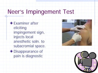 Neer’s Impingement Test
  Examiner after
  eliciting
  impingement sign,
  injects local
  anesthetic soln. to
  subacromial space.
  Disappearance of
  pain is diagnostic
 