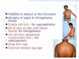 Inability to abduct or flex foreward
Atrophy of supra & infraspinatus
fossae
Empty can test - for supraspinatus
ER at arm at side with elbow
flexed- for infraspinatus
Lift off test/ abdominal
compression test – for
subscapularis
Drop Arm sign
External rotation lag sign
 