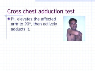 Cross chest adduction test
 Pt. elevates the affected
 arm to 90°, then actively
 adducts it.
 
