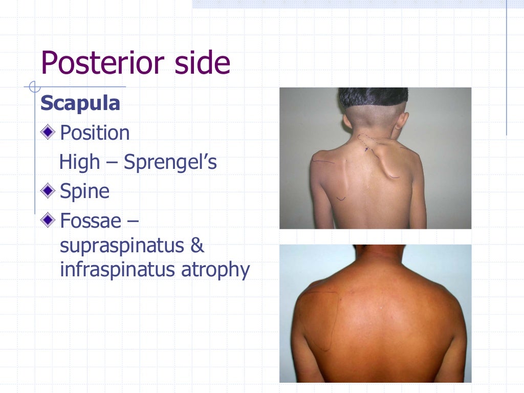 Shoulder examination